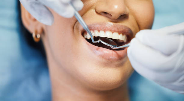 Best Holiday Emergency Dentist in Portola, CA